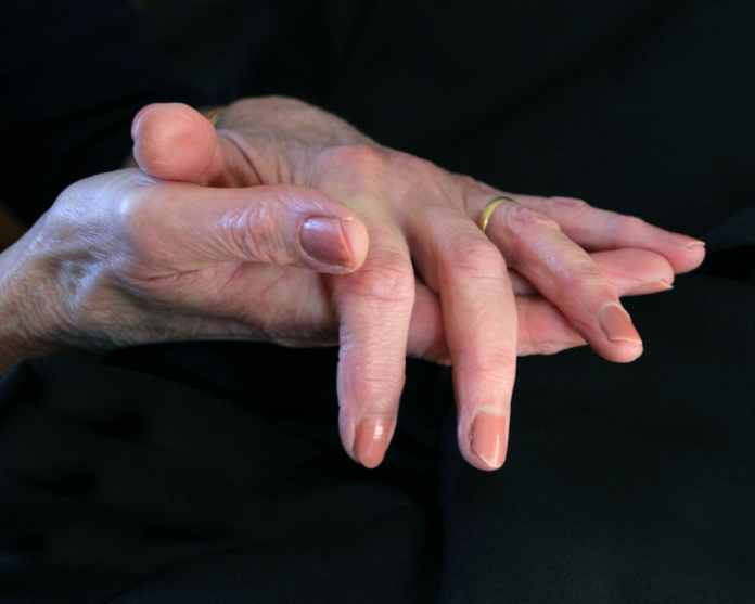 Gentle hands, one resting atop the other with a gold ring, placed calmly on dark fabric, symbolizing inner peace and self-compassion during mindful practice.